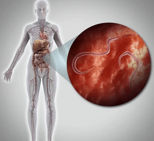 Paraziti u ljudskom tijelu