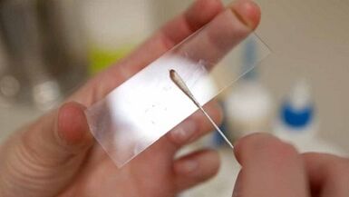 Calais analiza za identificiranje parazita