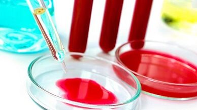 Ispitivanje krvi za parazite