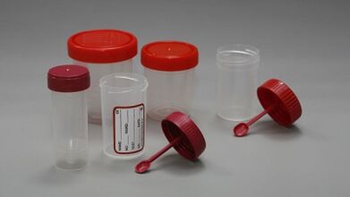 Kako se pripremiti za test parazita