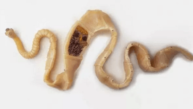 Kako otkriti prisutnost parazita u tijelu