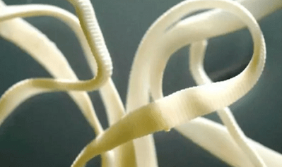 Kako ukloniti parazite iz ljudskog tijela