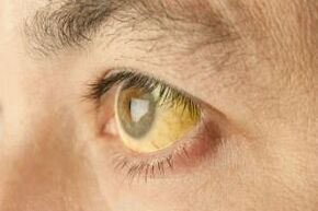 žutilo bjeloočnica